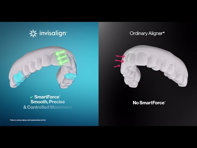 Invisalign | 5 Test Check - SmartForce
