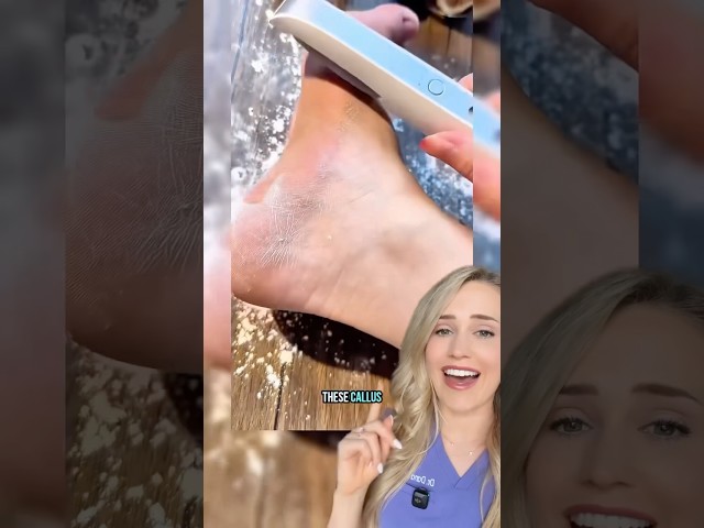 Doctor reacts: callus shaving device