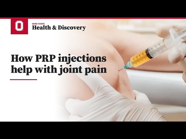How PRP injections help with joint pain | Ohio State Medical Center