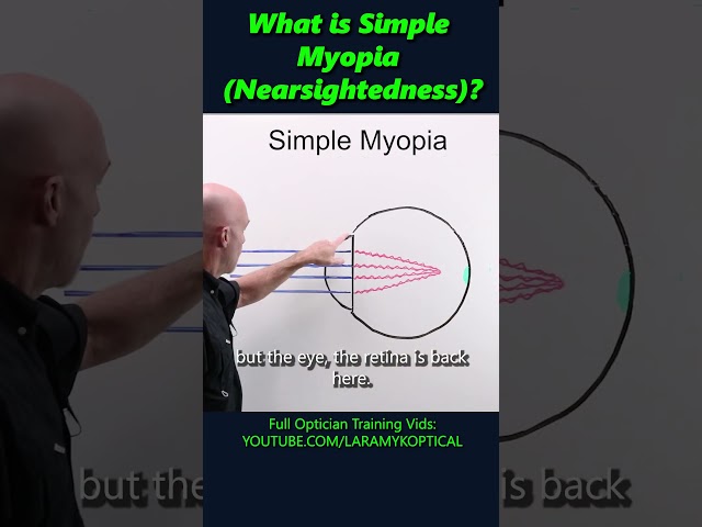 What is simple Myopia (Nearsightedness)?