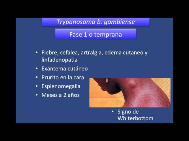 umh2658 2013-14 Lec50 Tripanosomiasis africana