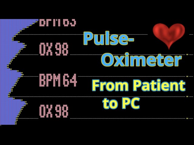 Bluetooth Pulse-Oximeter monitored, logs, and alarms with my own computer. Free opensource project
