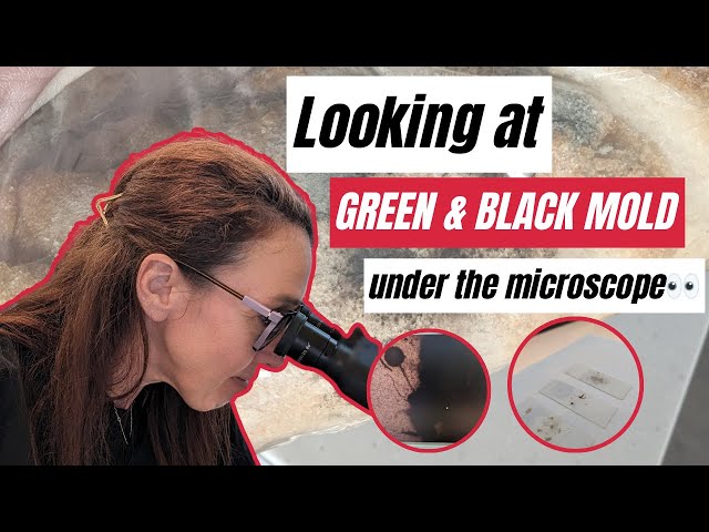 Mold Under the Microscope😱🔬