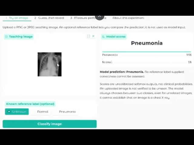 Tutorial Video on Medical Image Classification (Hugging Face AutoTrain x ResNet18)