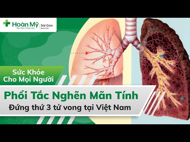 Chronic Obstructive Pulmonary Disease | Understand Causes, Symptoms, Complications
