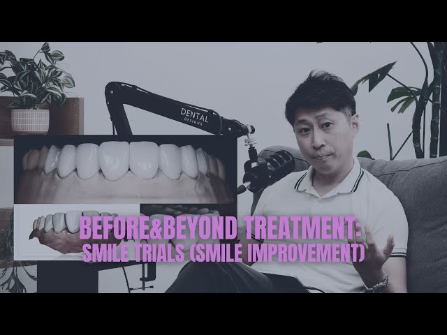 Before Veneers or Crowns: How a Smile Trial Shapes Your Smile | BEFORE & BEYOND EP11