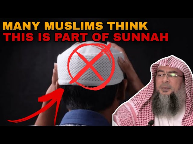 What's the Definition of Sunnah? Is Prolonging the Hair and Wearing Caps Sunnah? || Assim Al Hakeem