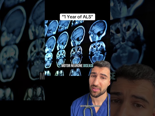 “1 Year of ALS” #changes