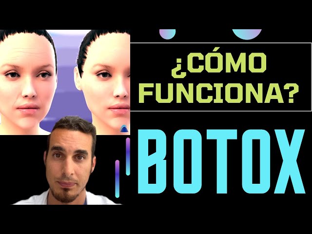 BOTOX en la cara - ¿Cómo se APLICA y cómo FUNCIONA? - #shorts