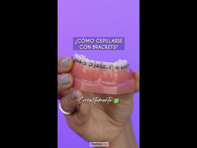 How to Brush Your Teeth with Braces 🦷 - Laser Dentistry #Shorts