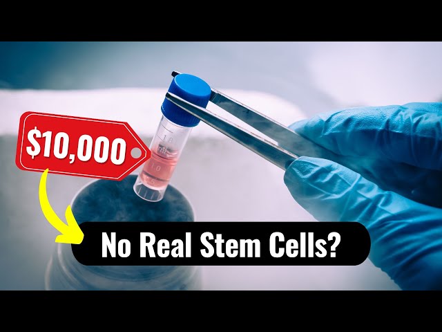 The Truth About Stem Cell Treatments Explained