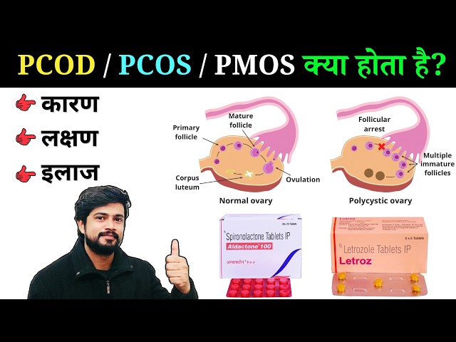 PCOD और PCOS kya Hota Hai || Cause || Symptoms || Treatment || Disease || Pharmacy | Nursing | Ovary