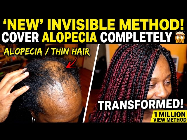 "NEW" Crochet Hairstyle Method l Alopecia l Thin Hair Friendly