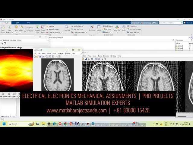 🧠 CT Brain Image Reconstruction in MATLAB | Medical Imaging Simulation