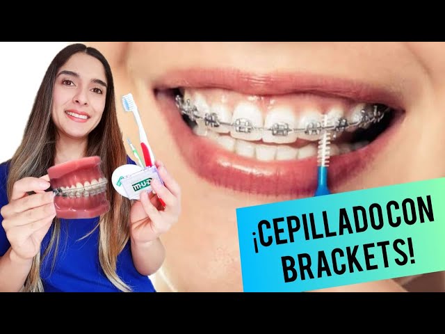 HOW TO BRUSH YOUR TEETH WITH BRACES ✅ | THE BEST TECHNIQUE AND EVERYTHING YOU NEED❗❗