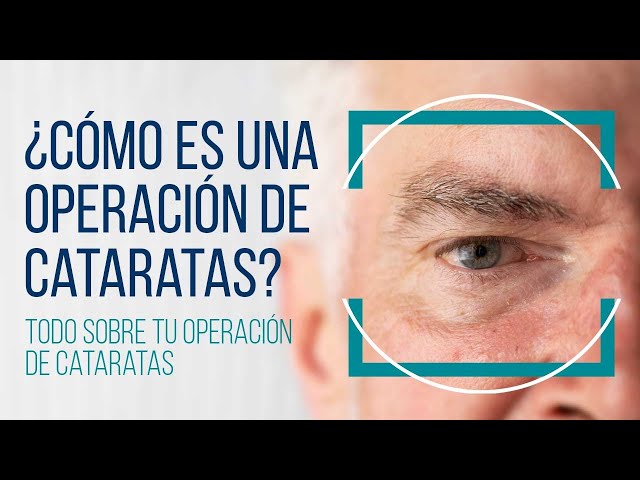Todo sobre tu operación de cataratas #cataratas  #cirugiadecataratas