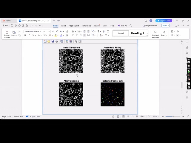 Automated Blood Cell Counting & Classification Using MATLAB Image Processing