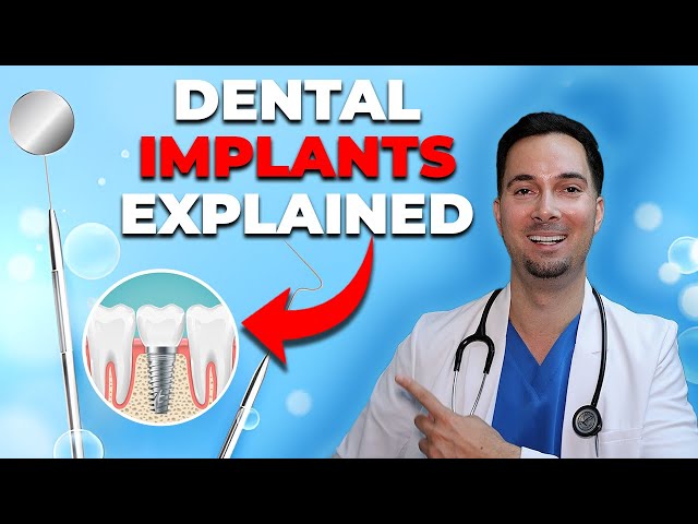 Dental implant procedure (simple guide)