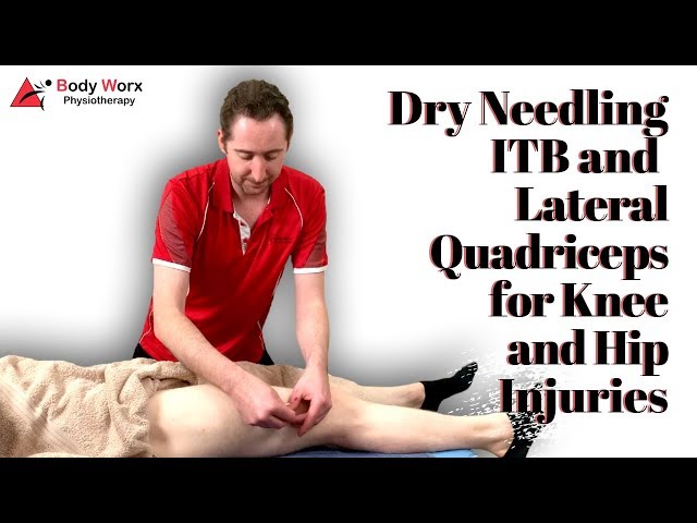 Dry Needling for ITB Syndrome | Fast Relief for Hip & Knee Pain