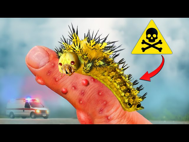 Stung by a Venomous Caterpillar! (Hospital Trip?!)