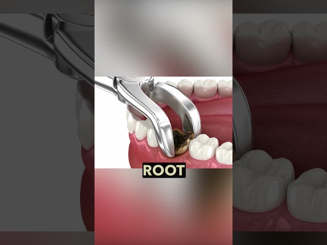 Cavities Explained | What Happens If You Ignore Tooth Decay?