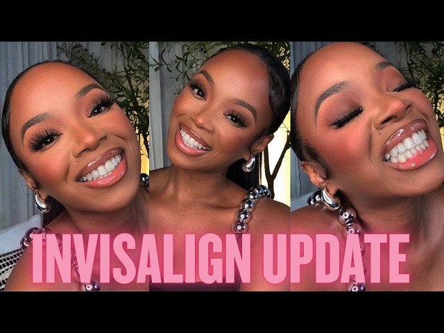 I'm FINALLY DONE with Invisalign! My 14 Year Teeth Journey | Invisalign | Braces & Final Results