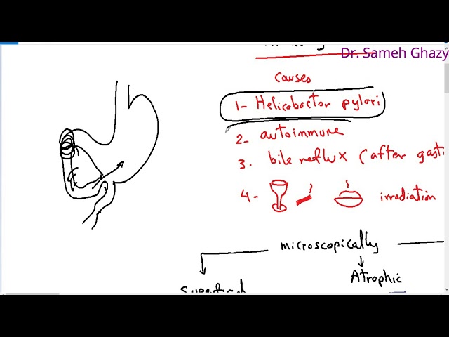 Systemic pathology 22 : GIT 3  ( gastritis ) DR.SAMEH GHAZY
