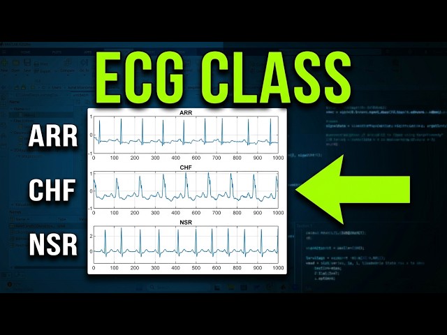Classify Heart Arrhythmias with AI on MATLAB