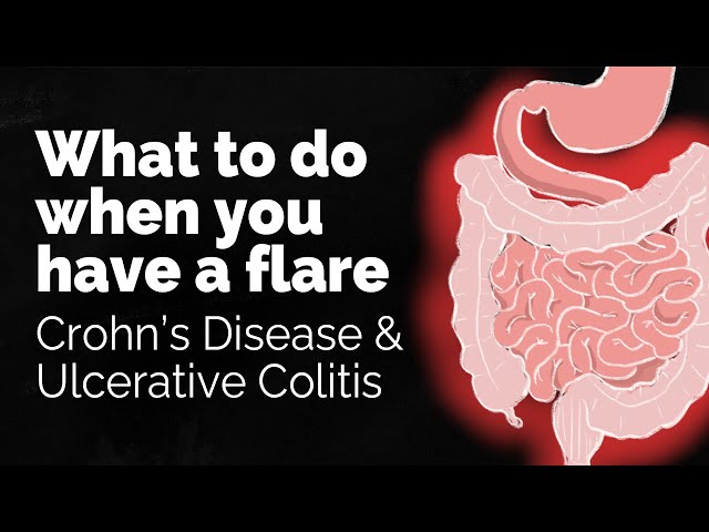 Qué hacer si tiene un brote de enfermedad de Crohn o colitis ulcerosa | GI Society
