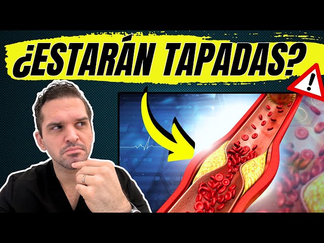 How to KNOW if your HEART arteries are CLOGGED ✅