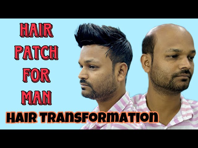 Hair Patch For Men | Hair Patch Center In India | Hair Stylish In Patch |