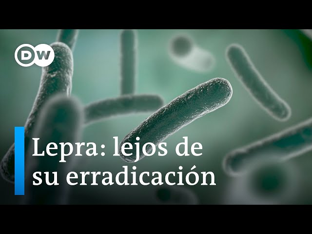 Leprosy, a disease that continues to affect millions of people