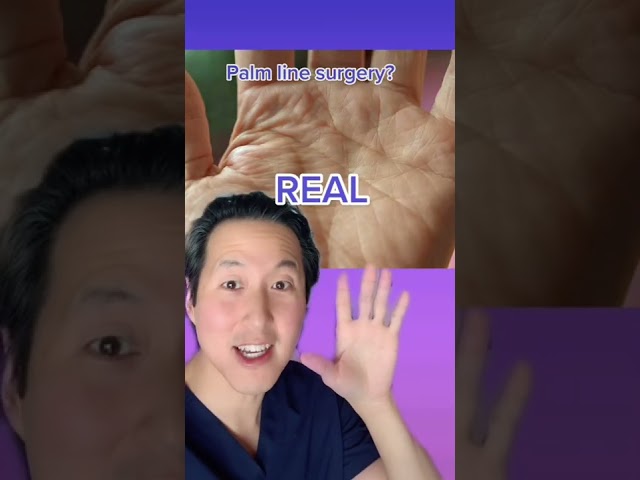 Bizarre Plastic Surgeries: REAL or SUS? #shorts #extreme #plasticsurgery