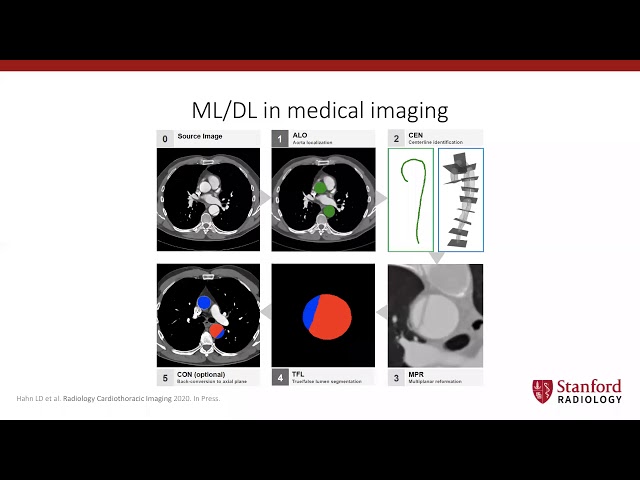 Webinar 31 Preparing medical imaging data for machine learning by Martin Willemink
