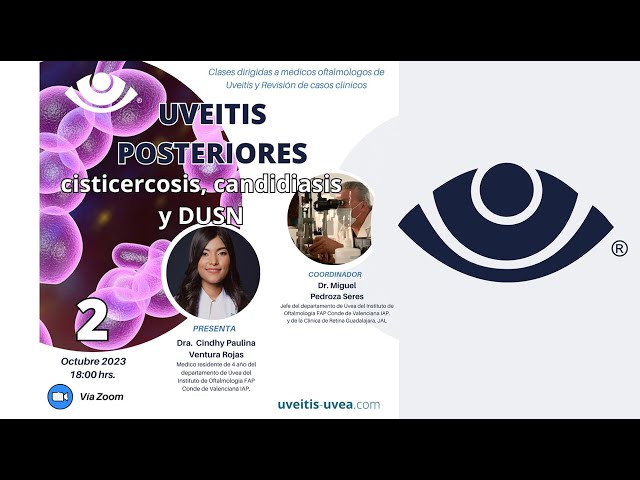 Uveitis Posteriores cisticercosis, candidiasis y DUSN