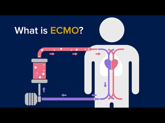What is ECMO? - Lifesaving Support for Failing Organs (Including COVID-19 Cases)