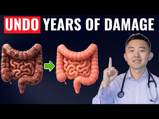 Gut Detox: The Fastest Way To Repair Your Gut Naturally (Backed by Science)