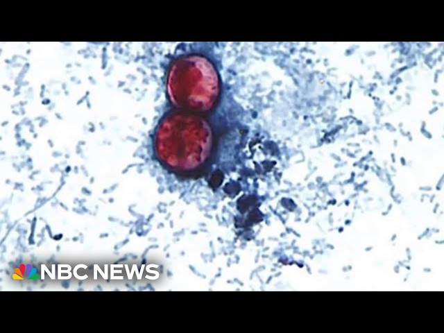 Federal program cuts spark concern over FDA and CDC response to cyclospora