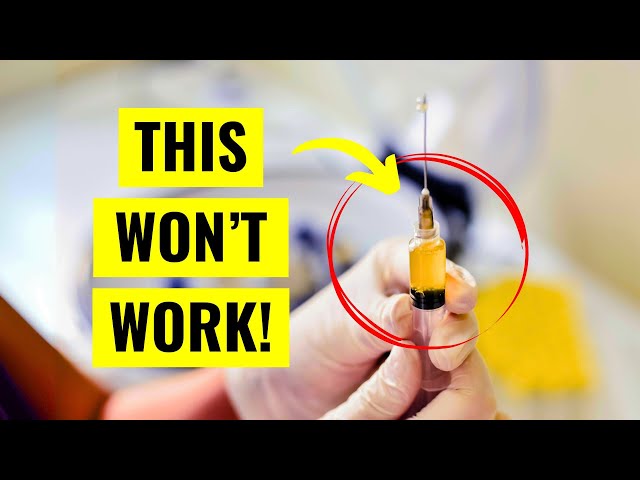 Why Your PRP Injection Might Be Useless (Unless You Ask THIS)