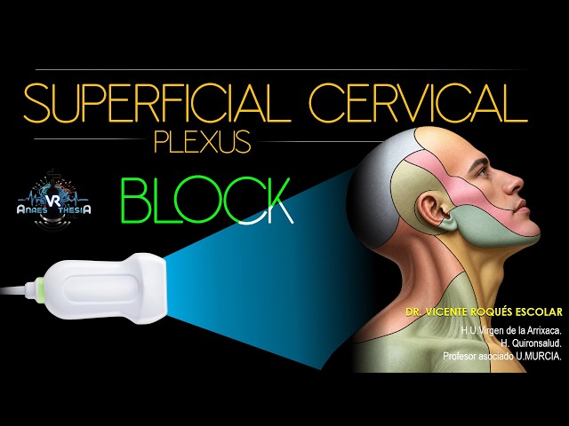 SUPERFICIAL CERVICAL PLEXUS BLOCK