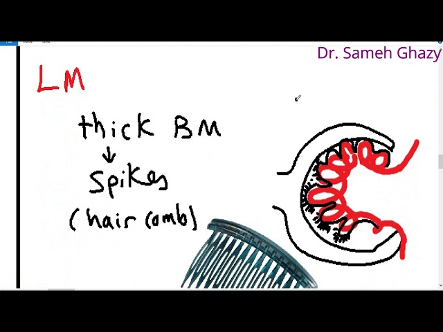 systemic pathology 49 : Urinary system 3  ( nephrotic syndrome ) DR. SAMEH GHAZY