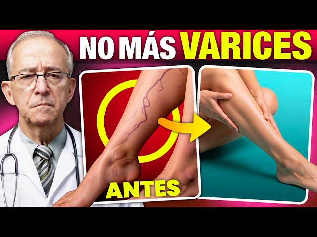 🦵 Si ves venas muy marcadas en las piernas, esto es lo que está pasando - Oswaldo Restrepo RSC