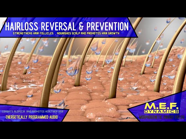 Hair loss Reversal & Prevention