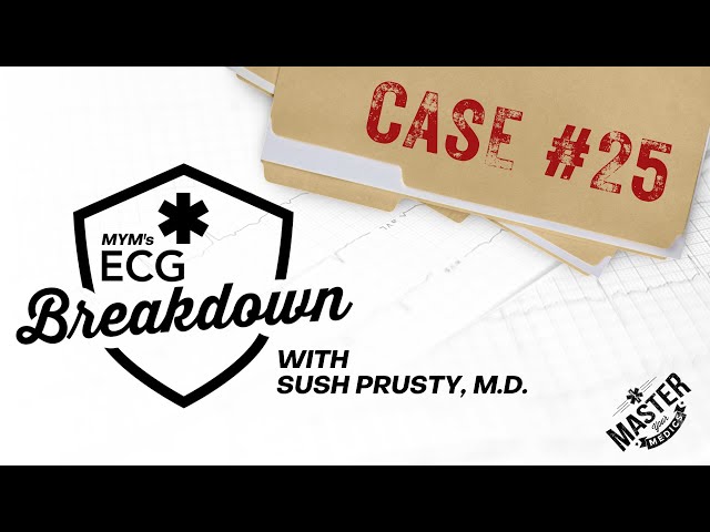 Case #25 | ECG Breakdown