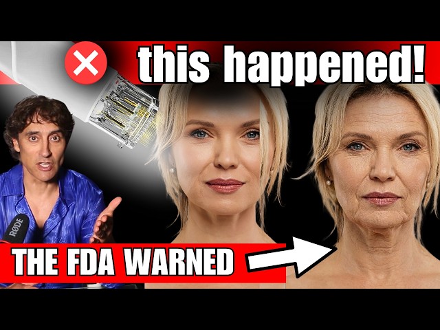 Everyone’s Getting This  Face Treatment