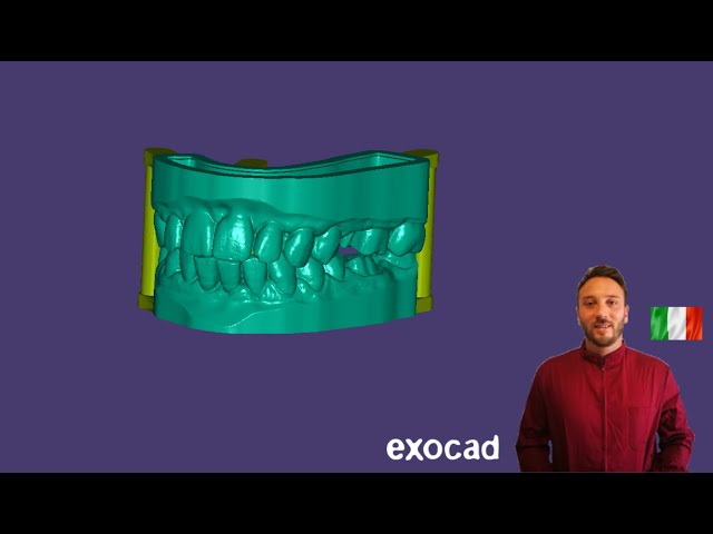 [EXOCAD] Model Creator