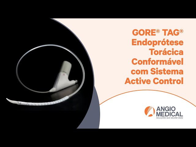 GORE® TAG® Active Control