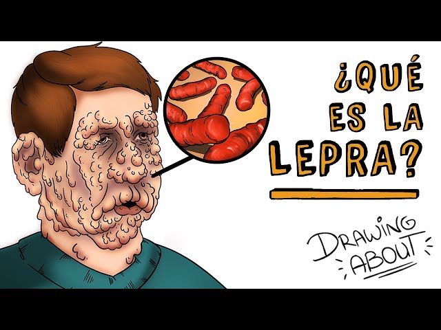 LEPRA | Draw My Life