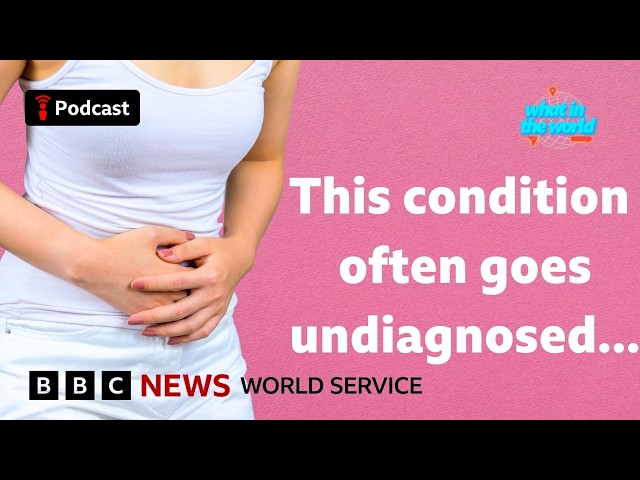 Will renaming PCOS help women get diagnosed? - What in the World podcast, BBC World Service