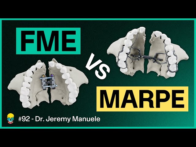 What REALLY Makes FME Special? Never Before Seen Images | Dr. Jeremy Manuele #92